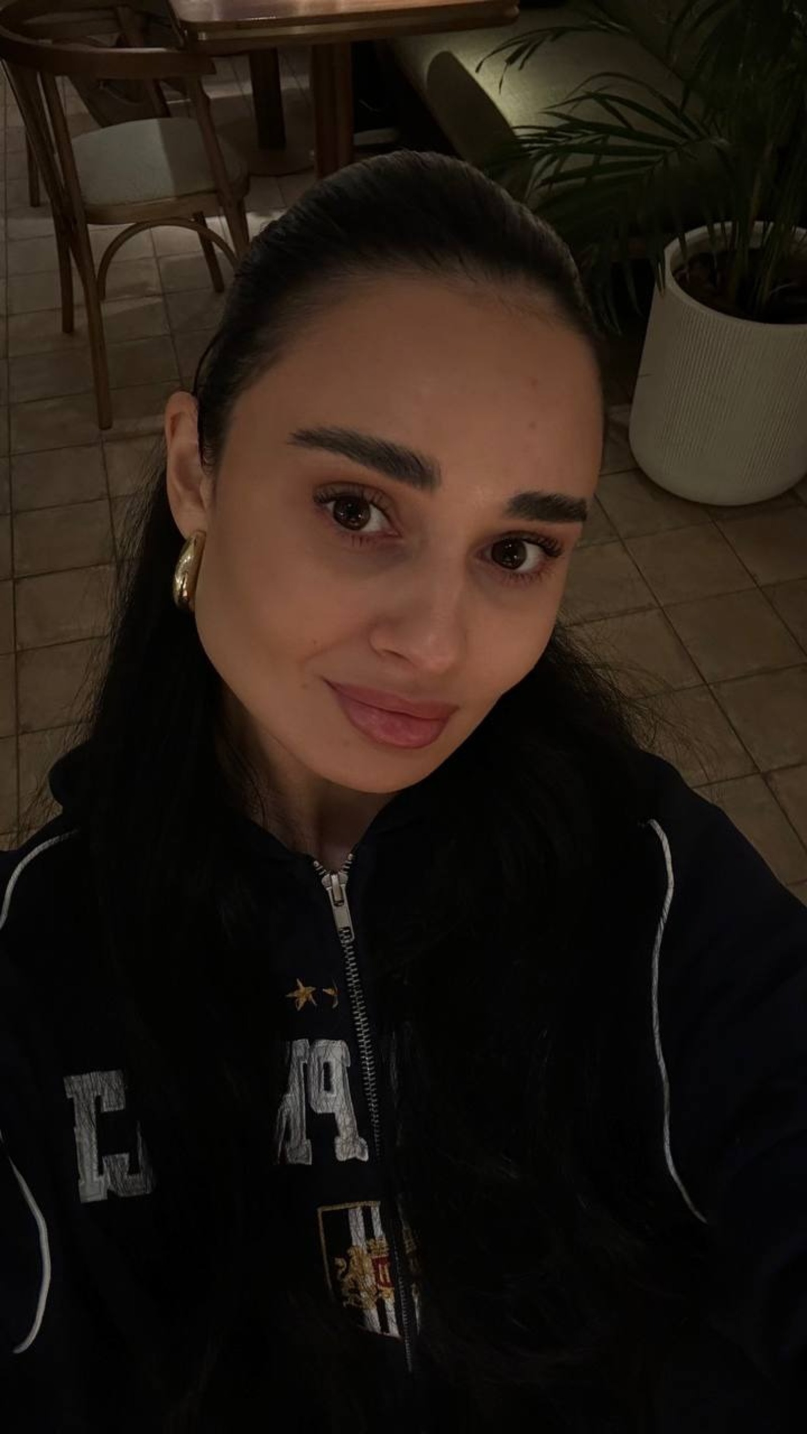 Башҡорт йырсыһы Гөлназ Асаева пластик операциянан һуң үҙенең хәле хаҡында һөйлән