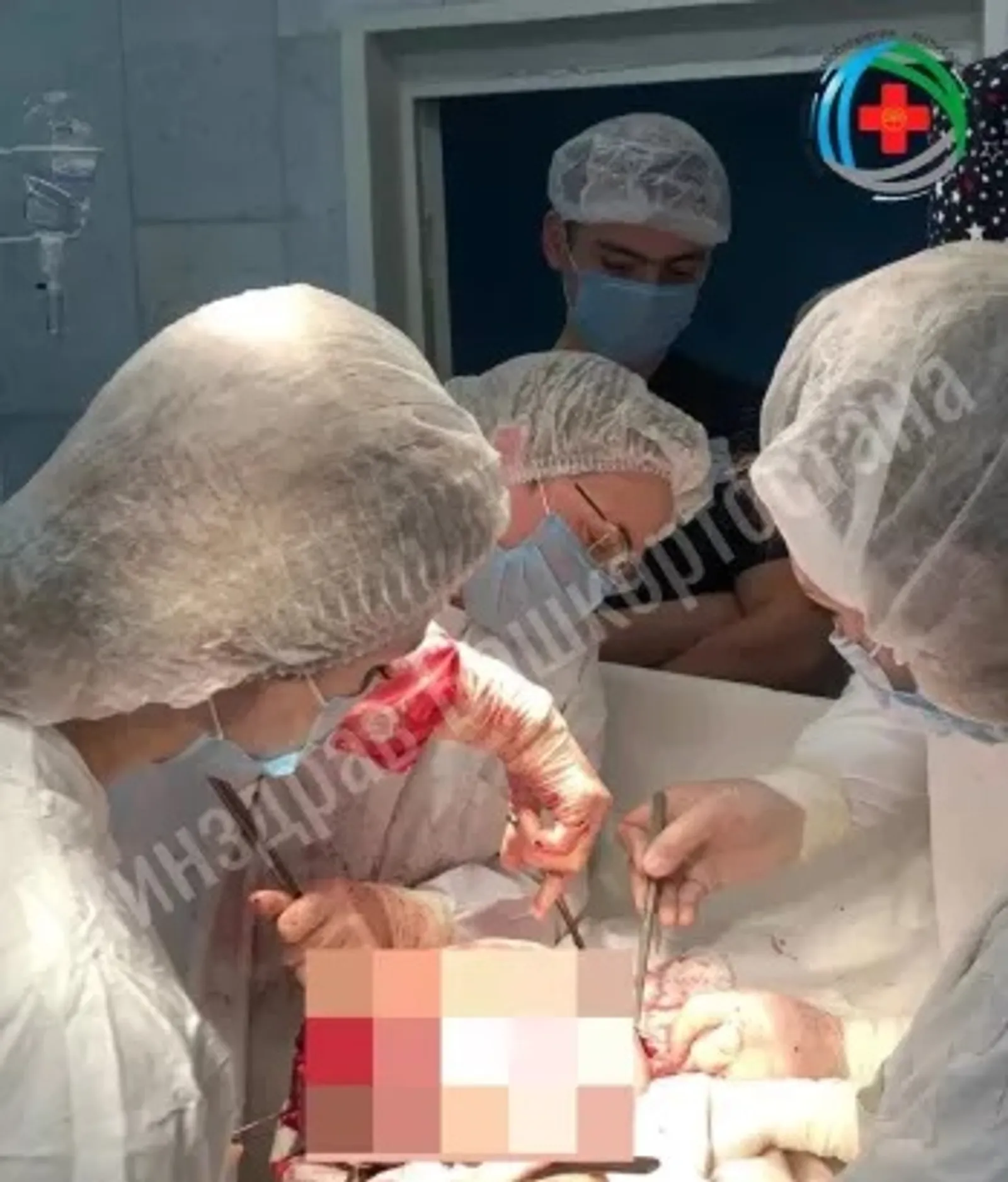 Уфимские врачи успешно удалили 4-килограммовую миому матки у 36-летней пациентки